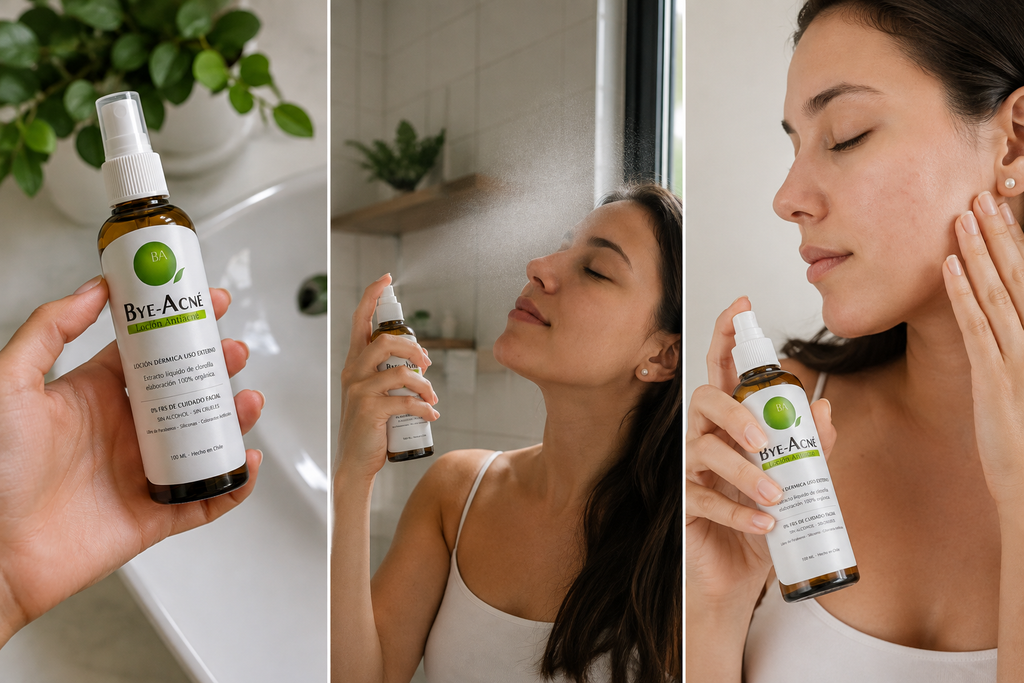 PACK Promoción 2 x Spray natural - BYE ACNÉ 100 ML
